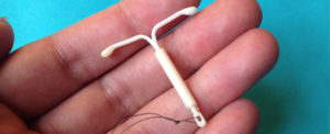 mirena IUD birth control implant on a hand