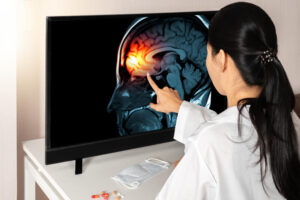 Experience Lawyer for Traumatic Brain Injury (TBI) in Birmingham AL area.