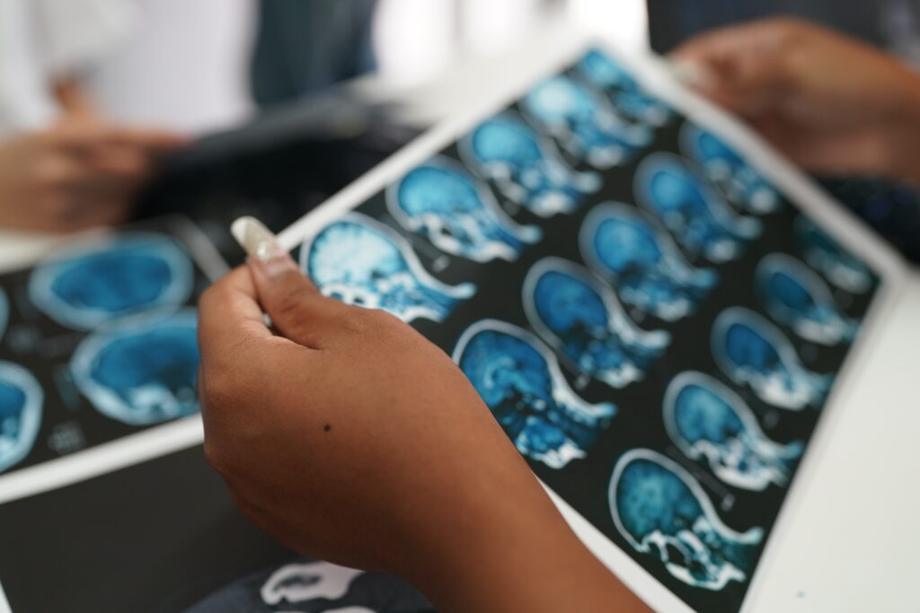 Depo-Provera Meningioma Lawsuits